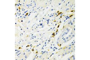 Immunohistochemistry of paraffin-embedded human stomach using NF-kB p65/RelA Antibody (ABIN3016234, ABIN3016235, ABIN3016236 and ABIN6219643) at dilution of 1:200 (40x lens).