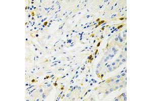 Immunohistochemistry of paraffin-embedded human stomach using NF-kB p65/RelA Antibody (ABIN3016234, ABIN3016235, ABIN3016236 and ABIN6219643) at dilution of 1:200 (40x lens). (NF-kB p65 anticorps  (AA 50-180))