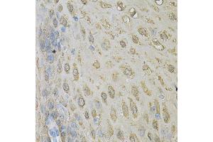 Immunohistochemistry of paraffin-embedded human esophagus using ALDH3A1 Antibody. (ALDH3A1 anticorps)