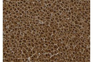 ABIN6272847 at 1/100 staining Rat liver tissue by IHC-P.