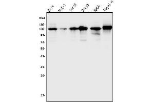 Western blot analysis of TRIM24 using anti-TRIM24 antibody (ABIN7602359).