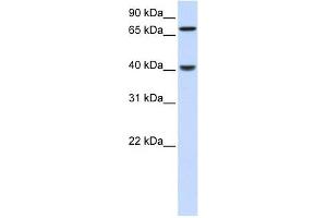 PDLIM3 antibody used at 1 ug/ml to detect target protein.