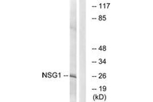 Western blot analysis of extracts from COLO cells, using NSG1 Antibody. (NSG1 anticorps  (AA 112-161))