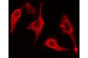 ABIN6275435 staining 293 cells by IF/ICC. (RAB3GAP1 anticorps  (Internal Region))