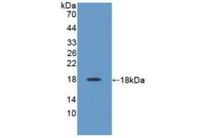 Figure. (IL-17 anticorps  (AA 18-150))