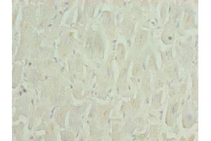 Immunohistochemistry of paraffin-embedded human heart tissue using ABIN7176171 at dilution of 1:100