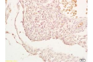 Formalin-fixed and paraffin embedded mouse embryo labeled with Anti-PHD2 Polyclonal Antibody, Unconjugated (ABIN702640) at 1:200, followed by conjugation to the secondary antibody and DAB staining
