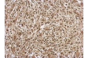 IHC-P Image Immunohistochemical analysis of paraffin-embedded C2C12 xenograft, using FGF13, antibody at 1:500 dilution.