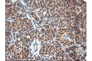 Image no. 4 for anti-Parvin, alpha (PARVA) antibody (ABIN1496442)