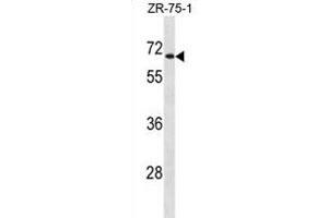 UGT2B28 Antibody (Center) (ABIN1881976 and ABIN2838847) western blot analysis in ZR-75-1 cell line lysates (35 μg/lane). (UGT2B28 anticorps  (AA 218-246))