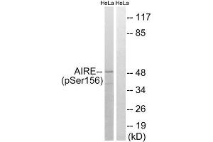 Western Blotting (WB) image for anti-Autoimmune Regulator (AIRE) (pSer156) antibody (ABIN1847730) (AIRE anticorps  (pSer156))