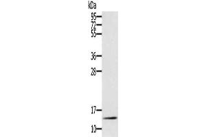 Gel: 12 % SDS-PAGE, Lysate: 40 μg, Lane: Mouse liver tissue, Primary antibody: ABIN7130906(RNF7 Antibody) at dilution 1/250, Secondary antibody: Goat anti rabbit IgG at 1/8000 dilution, Exposure time: 10 minutes (RNF7 anticorps)