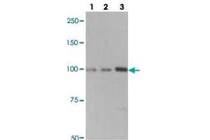 Western blot analysis of lane 1: A549 cell lysate, lane 2: H460 cell lysate and lane 3: H1703 cell lysate using MARS polyclonal antibody . (Mars (MARS) anticorps)