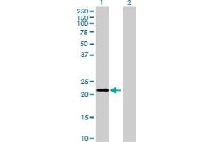 Western Blot analysis of FTH1 expression in transfected 293T cell line by FTH1 MaxPab polyclonal antibody. (FTH1 anticorps  (AA 1-183))