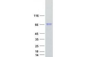Validation with Western Blot