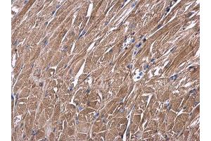 IHC-P Image USP4 antibody detects USP4 protein at cytoplasm in mouse muscle by immunohistochemical analysis.