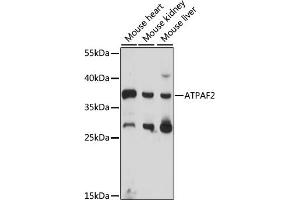 Western blot analysis of extracts of various cell lines, using  antibody (ABIN7265717) at 1000 dilution. (ATPAF2 anticorps  (AA 41-200))