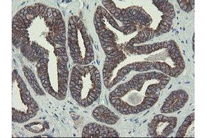 Image no. 12 for anti-Diphthamide Biosynthesis Protein 2 (DPH2) antibody (ABIN1497891)