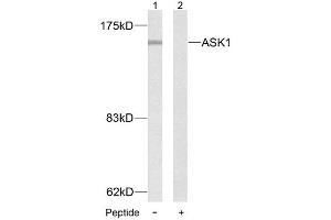 Western blot analysis of extract from MDA-MB- 435 cells, using ASK1 (Ab-83) antibody (E021125). (ASK1 anticorps)