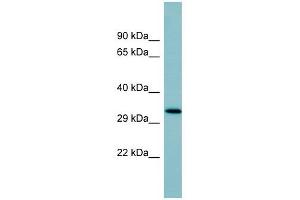 SFTPD antibody used at 1 ug/ml to detect target protein. (SFTPD anticorps  (Middle Region))