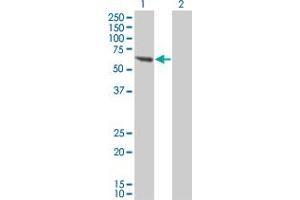 Western Blot analysis of PPM1B expression in transfected 293T cell line by PPM1B monoclonal antibody (M01), clone 1A3-2A4.