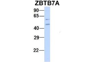 Host:  Rabbit  Target Name:  ZBTB7A  Sample Type:  MCF7  Antibody Dilution:  1. (ZBTB7A anticorps  (N-Term))