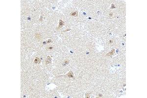 anti-Chromodomain Helicase DNA Binding Protein 2 (CHD2) (AA 1124-1351) antibody