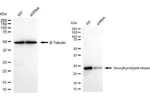 Western blotting analysis using Deoxythymidylate kinase antibody (ABIN7798311). (Recombinant DTYMK anticorps)
