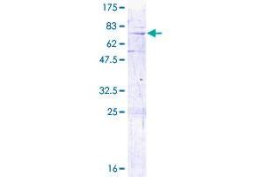 Image no. 1 for Mitochondrial Ribosomal Protein L3 (MRPL3) (AA 1-348) protein (GST tag) (ABIN1311316)