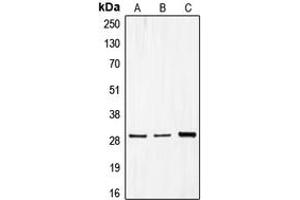 Western blot analysis of CDCA3 expression in MCF7 (A), Caco2 (B), HepG2 (C) whole cell lysates. (CDCA3 anticorps  (C-Term))