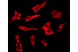 ABIN6276224 staining COLO205 by IF/ICC. (TAS2R19 anticorps  (Internal Region))