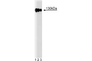 Western Blotting (WB) image for anti-Integrin beta 1 (ITGB1) (AA 76-256) antibody (ABIN967992) (ITGB1 anticorps  (AA 76-256))