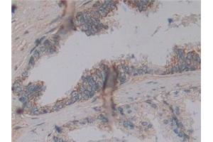 Detection of MFAP2 in Human Prostate Tissue using Polyclonal Antibody to Microfibrillar Associated Protein 2 (MFAP2)