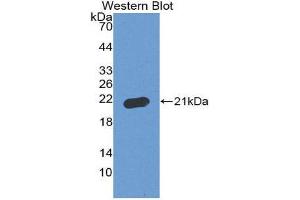 Western Blotting (WB) image for anti-Apoptosis-Associated tyrosine Kinase (AATK) (AA 1216-1374) antibody (ABIN3208648) (AATK anticorps  (AA 1216-1374))