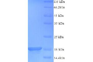 SDS-PAGE (SDS) image for Baculoviral IAP Repeat-Containing 5 (BIRC5) (AA 1-140), (full length) protein (His tag) (ABIN5713282)
