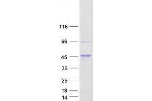 Validation with Western Blot