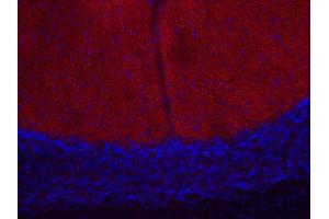 Indirect immunostaining of PFA fixed mouse cerebellum section (dilution 1 : 200; red). (CACNA1B anticorps)