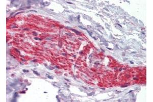 Nerve, Human: Formalin-Fixed, Paraffin-Embedded (FFPE) (Ankyrin G anticorps)