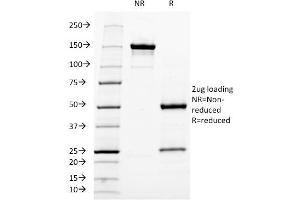 SDS-PAGE Analysis Purified Neurofilament Mouse Monoclonal Antibody (NF421). (NEFH anticorps)
