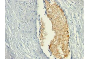 Formalin-fixed, paraffin-embedded human Placenta stained with AMPD3 Mouse Monoclonal Antibody (AMPD3/901) (AMPD3 anticorps)
