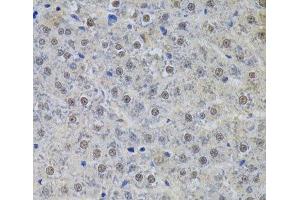 Immunohistochemistry of paraffin-embedded Rat liver using SNRPA Polyclonal Antibody at dilution of 1:100 (40x lens).
