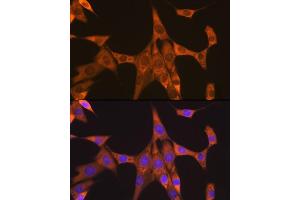 Immunofluorescence analysis of NIH-3T3 cells using FXR1 Rabbit mAb (ABIN7267257) at dilution of 1:100 (40x lens). (FXR1 anticorps)