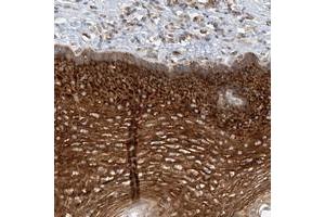 Immunohistochemical staining of human esophagus with LARP5 polyclonal antibody  shows strong cytoplasmic positivity in squamous epithelial cells at 1:200-1:500 dilution.