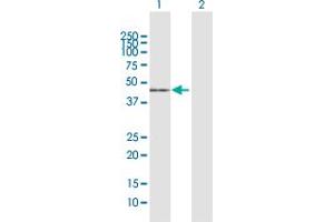 Western Blot analysis of ACADM expression in transfected 293T cell line by ACADM MaxPab polyclonal antibody. (Medium-Chain Specific Acyl-CoA Dehydrogenase, Mitochondrial (MCAD) (AA 1-421) anticorps)