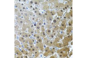 Immunohistochemistry of paraffin-embedded human liver damage using RNF166 antibody (ABIN6135036, ABIN6147021, ABIN6147024 and ABIN6224290) (40x lens). (RNF166 anticorps  (C-Term))