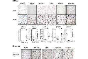 Immunohistochemistry of Anti-Apolipoprotein AI.