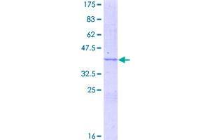 Image no. 1 for Hypoxia Up Regulated 1 (HYOU1) (AA 36-147) protein (GST tag) (ABIN1307312)