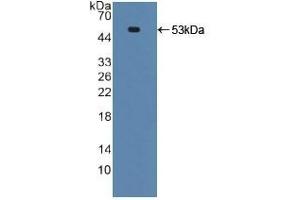 Detection of Recombinant TNFRSF10B, Human using Polyclonal Antibody to Death receptor 5 (DR5) (TNFRSF10B anticorps  (AA 234-435))