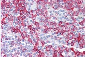 Anti-OGFOD1 antibody IHC staining of human tonsil. (OGFOD1 anticorps  (C-Term))