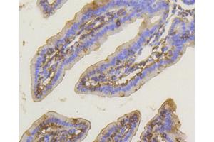 Immunohistochemistry of paraffin-embedded mouse intestin using PRKCA antibody (ABIN5997085) at dilution of 1/100 (40x lens). (PKC alpha anticorps)